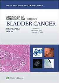 Image of ADVANCES IN SURGICAL PATHOLOGY : BLADDER CANCER