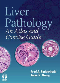 Image of LIVER PATHOLOGY AN ATLAS & CONCISE GUIDE